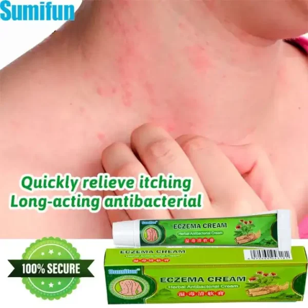 20g anti eczema cream ointment psoriasis cream relieve itching treatment of eczema. Experience the convenience of modern retail with hotep.ng, Nigeria's premier online marketplace. We bring you a diverse range of products from trusted sellers and brands. Enjoy our user-friendly platform and reliable delivery services.